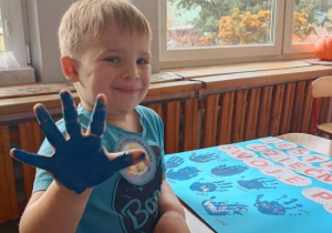 Chłopiec pokazuje niebieską dłoń.